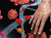 Dominica to continue monitoring the developments regarding the Mpox virus