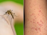 Dominicans advised to take measures to protect themselves against vector borne diseases