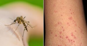 Dominicans advised to take measures to protect themselves against vector borne diseases