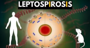 A Dominican male has died from leptospirosis