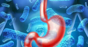 The Ministry of Health is reporting an end to the recent gastroenteritis outbreak in Dominica