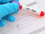 Over 180 new STIs cases recorded in Dominica between 2020 and 2024.